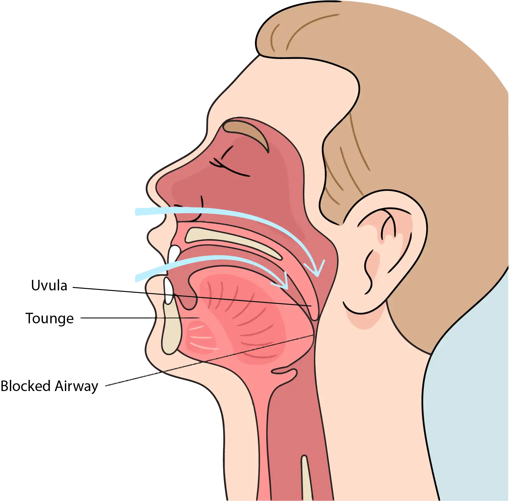 Sleep Apnea Treatment