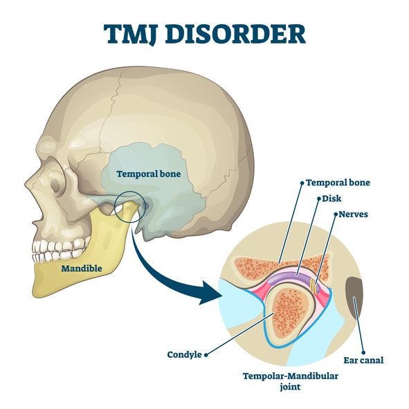 TMJ Relief