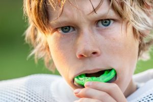 Performance Mouthwear